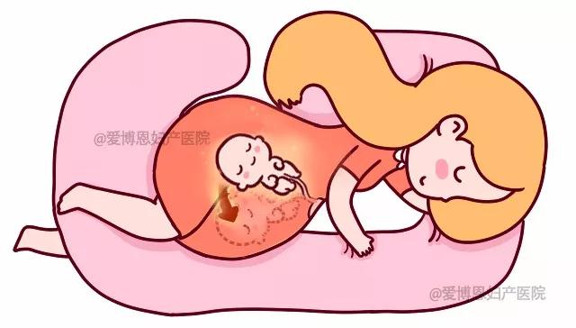 出诊记 | 孕期左侧睡不舒服怎么办